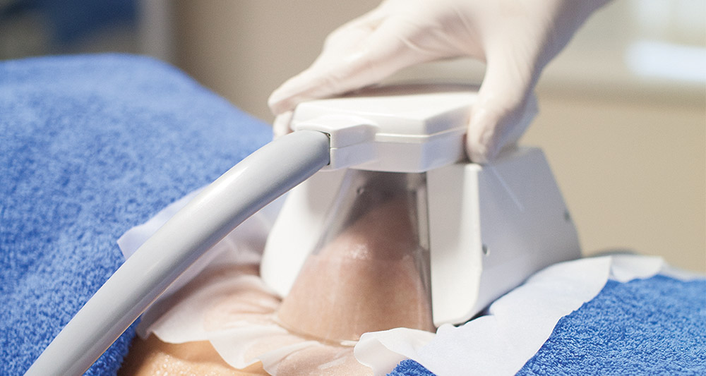 How Fat Freezing and HIFU Work Together? 2 Multiple Areas in One Session HIFU and Fat Freezing Royal Tunbridge Wells